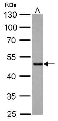 Western Blot: Smad5 Antibody [NBP2-20413]