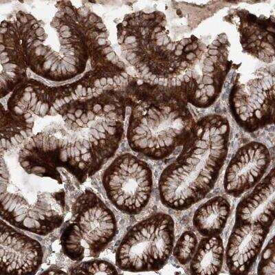 Immunohistochemistry-Paraffin: SMAP1 Antibody [NBP1-83702]