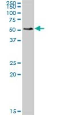 Western Blot: SMAP1 Antibody [H00060682-B01P]