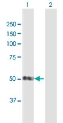 Western Blot: SMAP1 Antibody [H00060682-B01P]