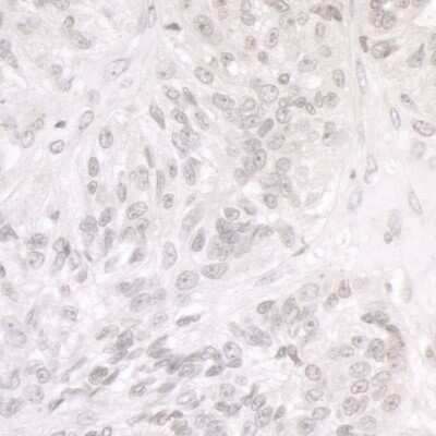 Immunohistochemistry: SMARCA1 Antibody [NB100-57524]