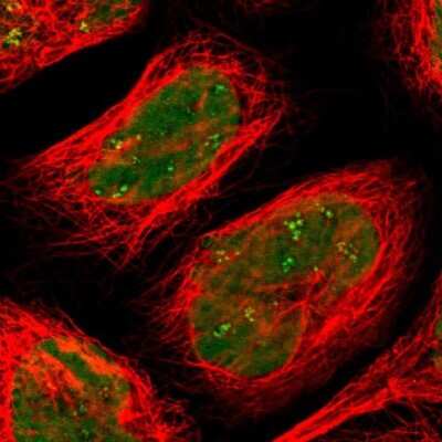 Immunocytochemistry/ Immunofluorescence: SMARCA5/SNF2H Antibody [NBP1-89692]