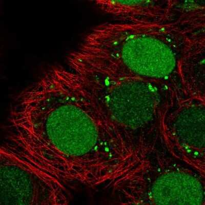 Immunocytochemistry/ Immunofluorescence: SMARCA6 Antibody [NBP2-38986]