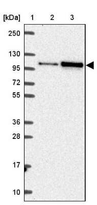 Western Blot: SMARCA6 Antibody [NBP2-38986]