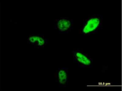 Immunocytochemistry/ Immunofluorescence: SMARCAD1 Antibody [H00056916-B01P]