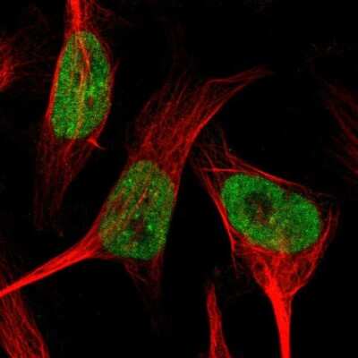 Immunocytochemistry/ Immunofluorescence: SMARCAD1 Antibody [NBP1-85023]