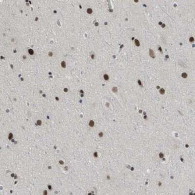Immunohistochemistry-Paraffin: SMARCAD1 Antibody [NBP1-85023]