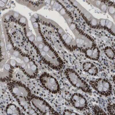 Immunohistochemistry-Paraffin: SMARCAD1 Antibody [NBP1-85023]