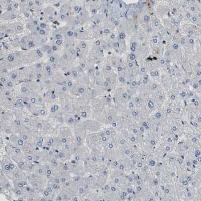 Immunohistochemistry-Paraffin: SMARCAD1 Antibody [NBP1-85023]