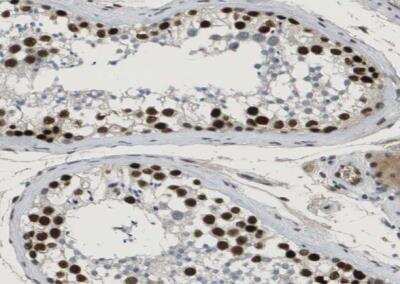 Immunohistochemistry-Paraffin: SMARCAD1 Antibody [NBP1-85023]