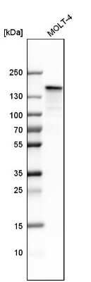 Western Blot: SMARCAD1 Antibody [NBP1-85023]