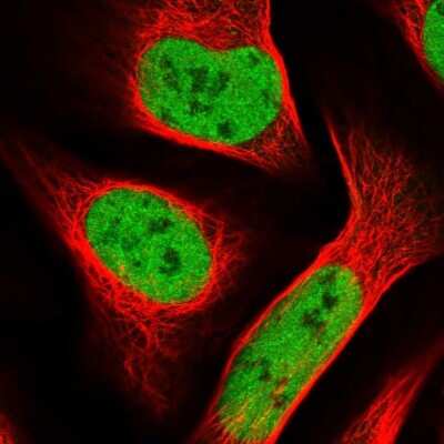 Immunocytochemistry/ Immunofluorescence: SMARCC1 Antibody [NBP1-88721]