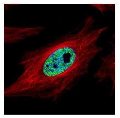 Immunocytochemistry/ Immunofluorescence: SMARCC1 Antibody [NBP2-20415]
