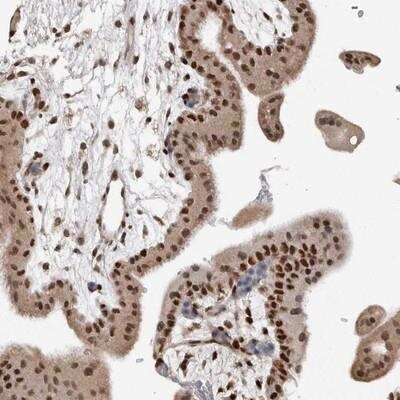 Immunohistochemistry: SMARCC1 Antibody [NBP1-88721]