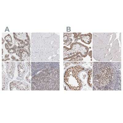 Immunohistochemistry-Paraffin: SMARCC1 Antibody [NBP1-88720]