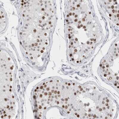 Immunohistochemistry-Paraffin: SMARCC1 Antibody [NBP1-88720]
