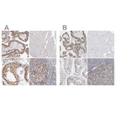 Immunohistochemistry-Paraffin: SMARCC1 Antibody [NBP1-88721]
