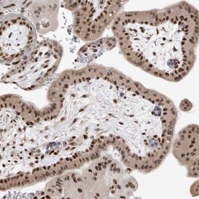 Immunohistochemistry-Paraffin: SMARCC1 Antibody [NBP1-88721]