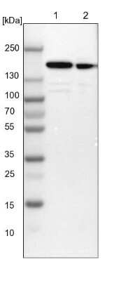 Western Blot: SMARCC1 Antibody [NBP1-88720]
