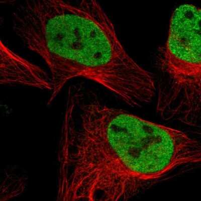 Immunocytochemistry/ Immunofluorescence: SMARCC2/BAF170 Antibody [NBP1-90017]