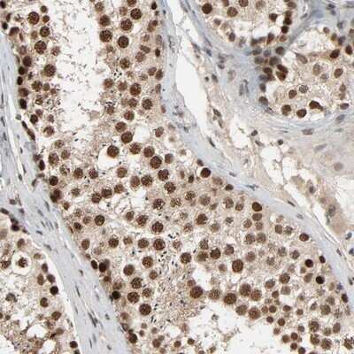 Immunohistochemistry-Paraffin: SMARCD1 Antibody [NBP1-88719]