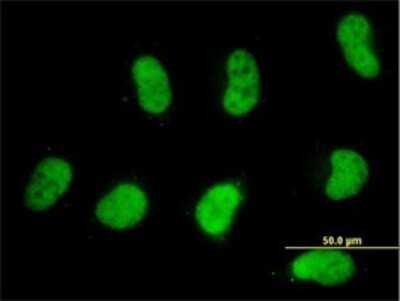 Immunocytochemistry/ Immunofluorescence: SMARCD2 Antibody (2B2) [H00006603-M02]