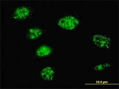 Immunocytochemistry/ Immunofluorescence: SMARCD3 Antibody (1G6) [H00006604-M01]