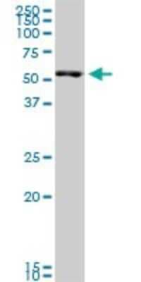 Western Blot: SMARCD3 Antibody (5B6) [H00006604-M04]