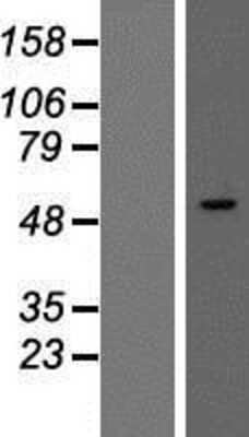 Western Blot: SMARCD3 Overexpression Lysate [NBP2-08040]