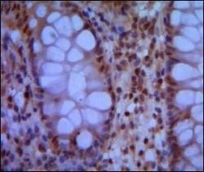 Immunohistochemistry-Paraffin: SMC1 Antibody (5B6) - BSA Free [NBP1-51596]
