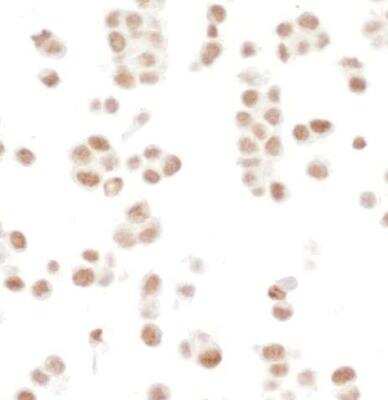 Immunocytochemistry: SMC1 Antibody (BL-205-2G8) [NBP2-76412]