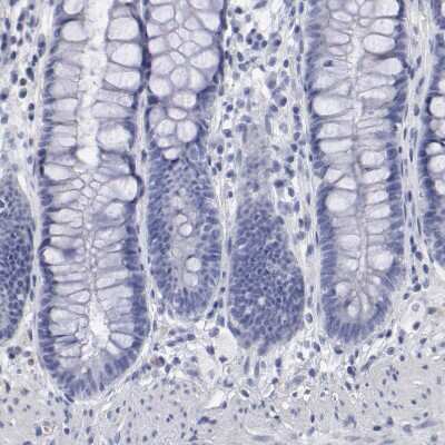 Immunohistochemistry-Paraffin: SMC1L2 Antibody [NBP1-89966]