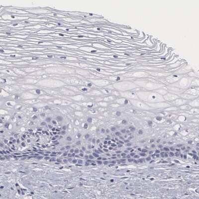 Immunohistochemistry-Paraffin: SMC1L2 Antibody [NBP1-89966]