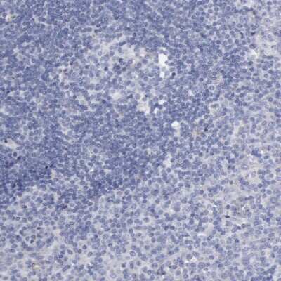 Immunohistochemistry-Paraffin: SMC1L2 Antibody [NBP1-89966]