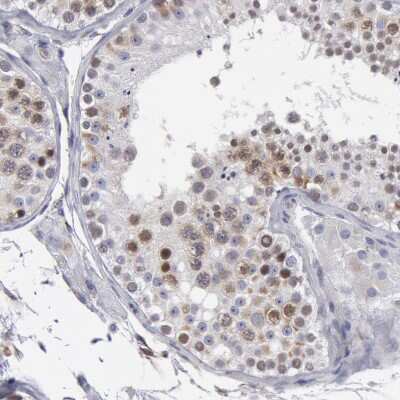 Immunohistochemistry-Paraffin: SMC1L2 Antibody [NBP1-89966]