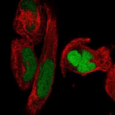 Immunocytochemistry/ Immunofluorescence: SMC2 Antibody [NBP2-49655]
