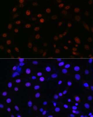 Immunocytochemistry/ Immunofluorescence: SMC3 Antibody (8W9R7) [NBP3-15798]