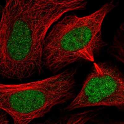 Immunocytochemistry/ Immunofluorescence: SMC3 Antibody [NBP2-58330]