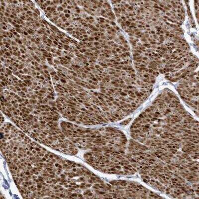 Immunohistochemistry: SMC3 Antibody [NBP1-88715]