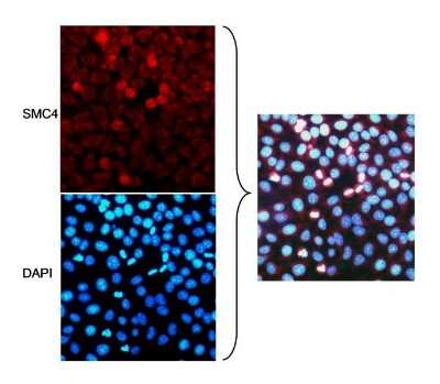 Immunocytochemistry/ Immunofluorescence: SMC4 Antibody [NB100-374]