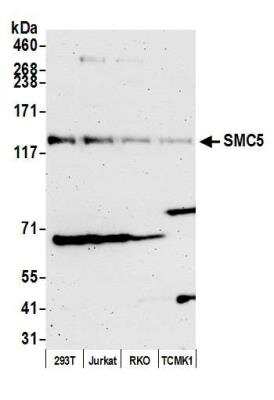 Western Blot: SMC5 Antibody [NB100-469]