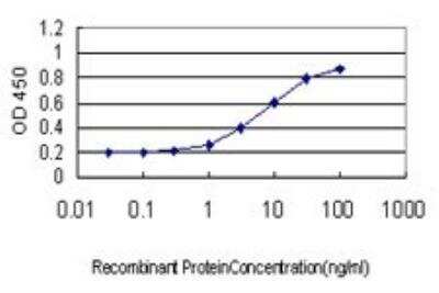 ELISA: SMC6L1 Antibody (2E6) [H00079677-M01]