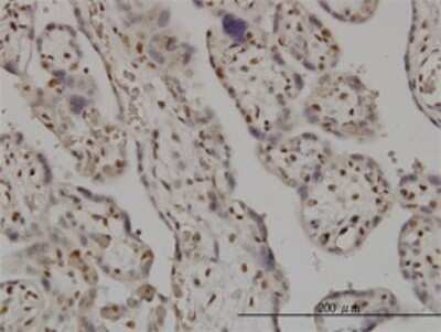 Immunohistochemistry-Paraffin: SMC6L1 Antibody (2E6) [H00079677-M01]