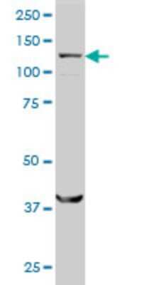 Western Blot: SMC6L1 Antibody (2E6) [H00079677-M01]