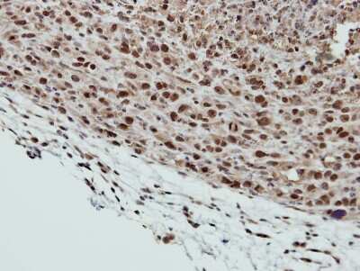Immunohistochemistry-Paraffin: SMC6L1 Antibody [NBP2-20420]