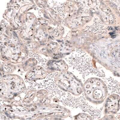Immunohistochemistry-Paraffin: SMC6L1 Antibody [NBP2-33378]