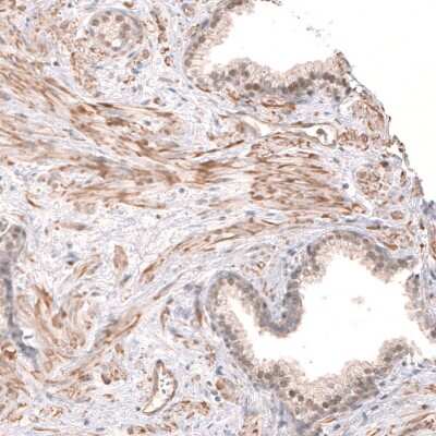 Immunohistochemistry-Paraffin: SMC6L1 Antibody [NBP2-33378]