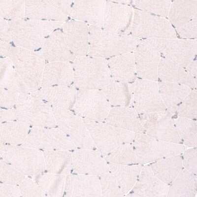 Immunohistochemistry-Paraffin: SMC6L1 Antibody [NBP2-33378]