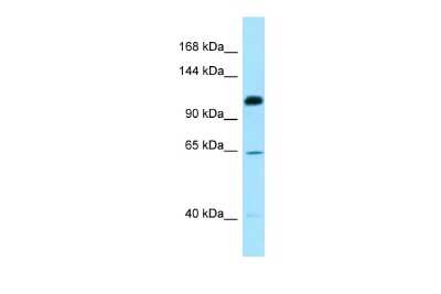 Western Blot: SMC6L1 Antibody [NBP3-09426]