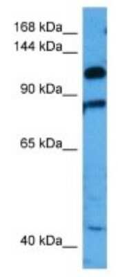 Western Blot: SMC6L1 Antibody [NBP3-10033]
